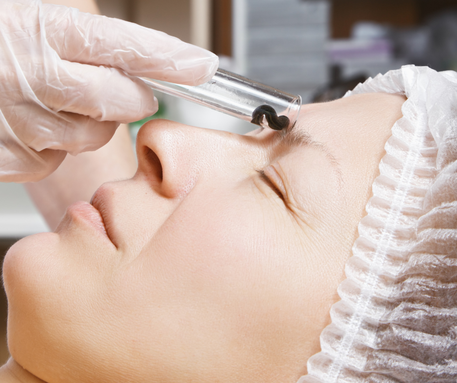 Terapia pijawkami w gabinecie kosmetycznym Atelier Zdrowia i Urody